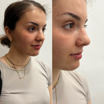 piercing