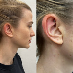 piercing