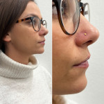 piercing