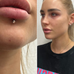 piercing