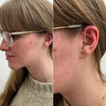 piercing