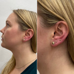 piercing
